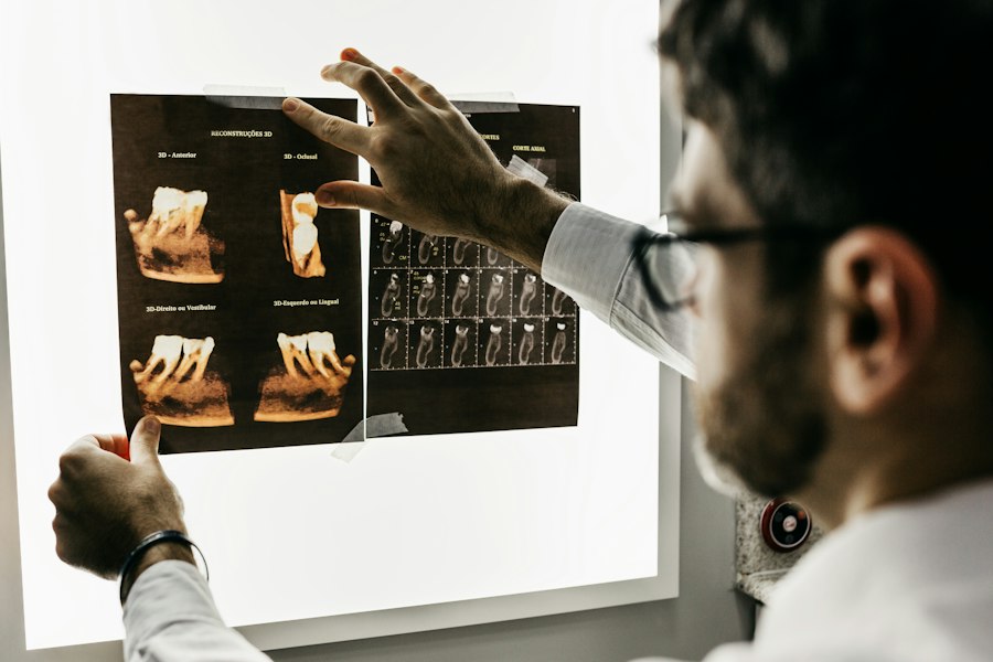 A doctor reviewing X-rays on a light panel